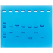 DNA Fingerprinting Using Restriction Enzymes
